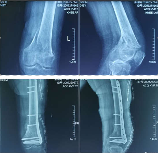 1655195933205945.png ct.png