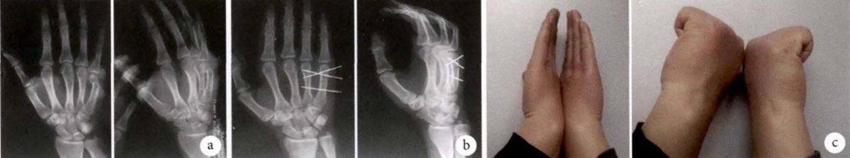 1695196850361752.jpg 02-002.jpg