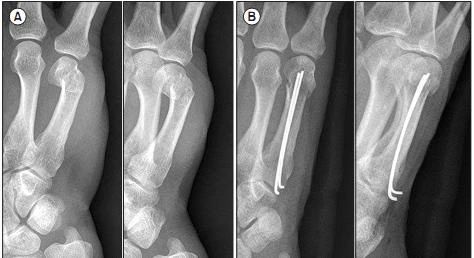 1695197110164253.jpg 02-004.jpg