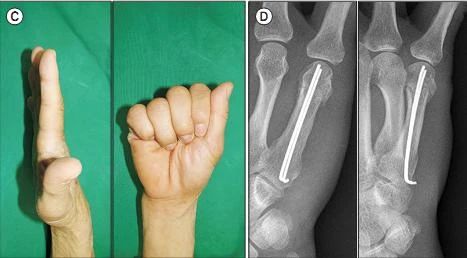 1695197126210717.jpg 02-005.jpg