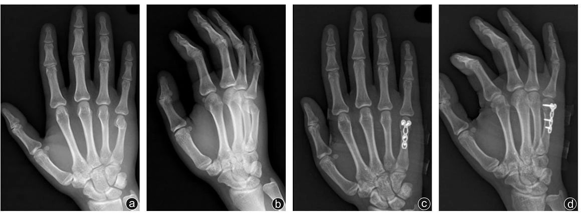 1695197305174569.jpg 02-008.jpg