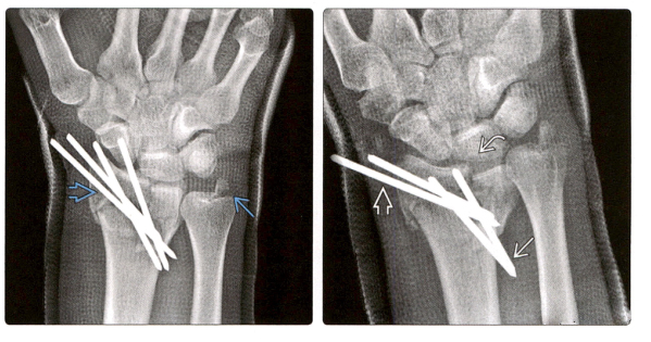 1698302844110489.jpg 失败3.jpg