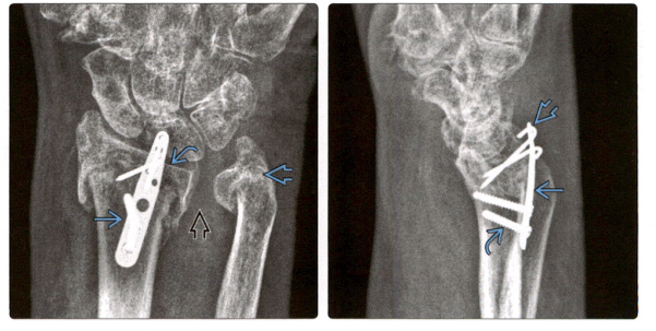 1698302935830042.jpg 失败4.jpg