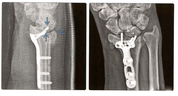 1698303017433418.jpg 失败5.jpg