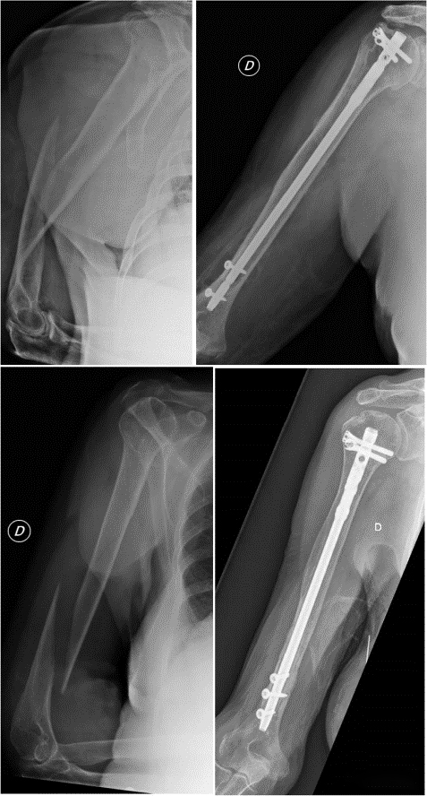 1698909513135683.jpg 640-(3).jpg