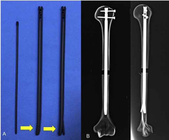 1698909617119385.jpg 640-(5).jpg