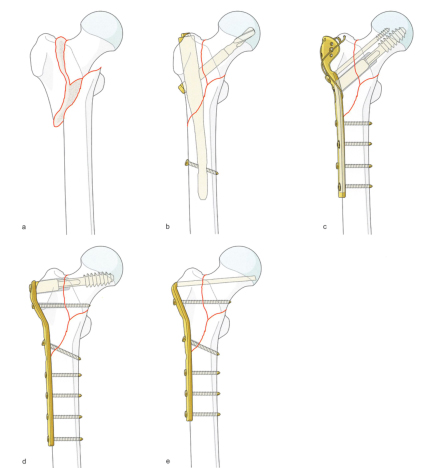 1702007307479819.jpg 6.jpg