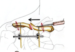 1703731920199675.png 4.png