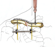 1703731941287441.png 6.png