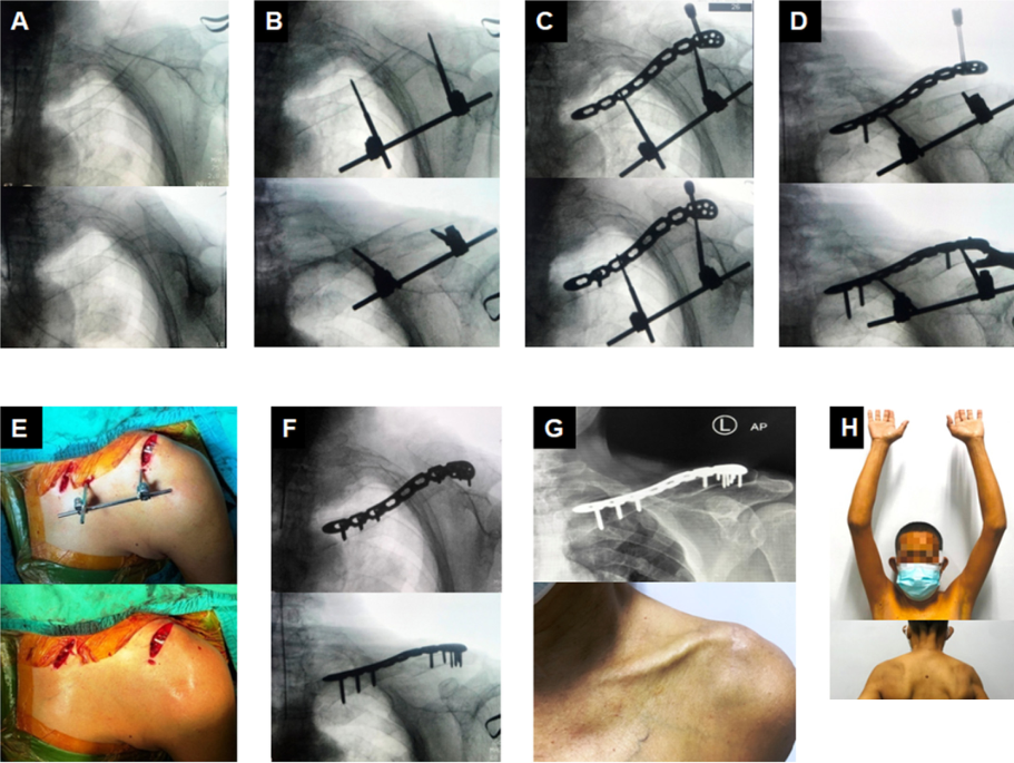 1703732004141780.png 10.png