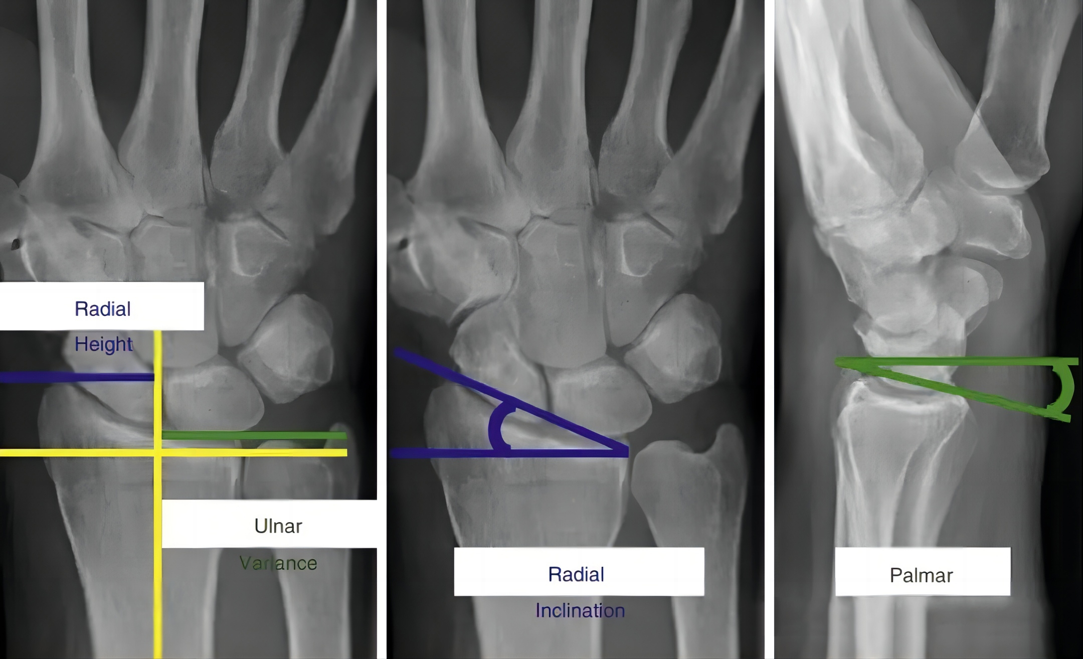 1711178713521874.jpg Henry02.jpg